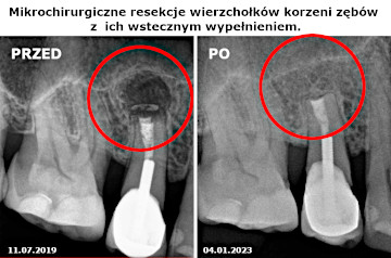 Endodonta Gliwice