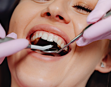 Plastyka recesji dziąseł Gliwice