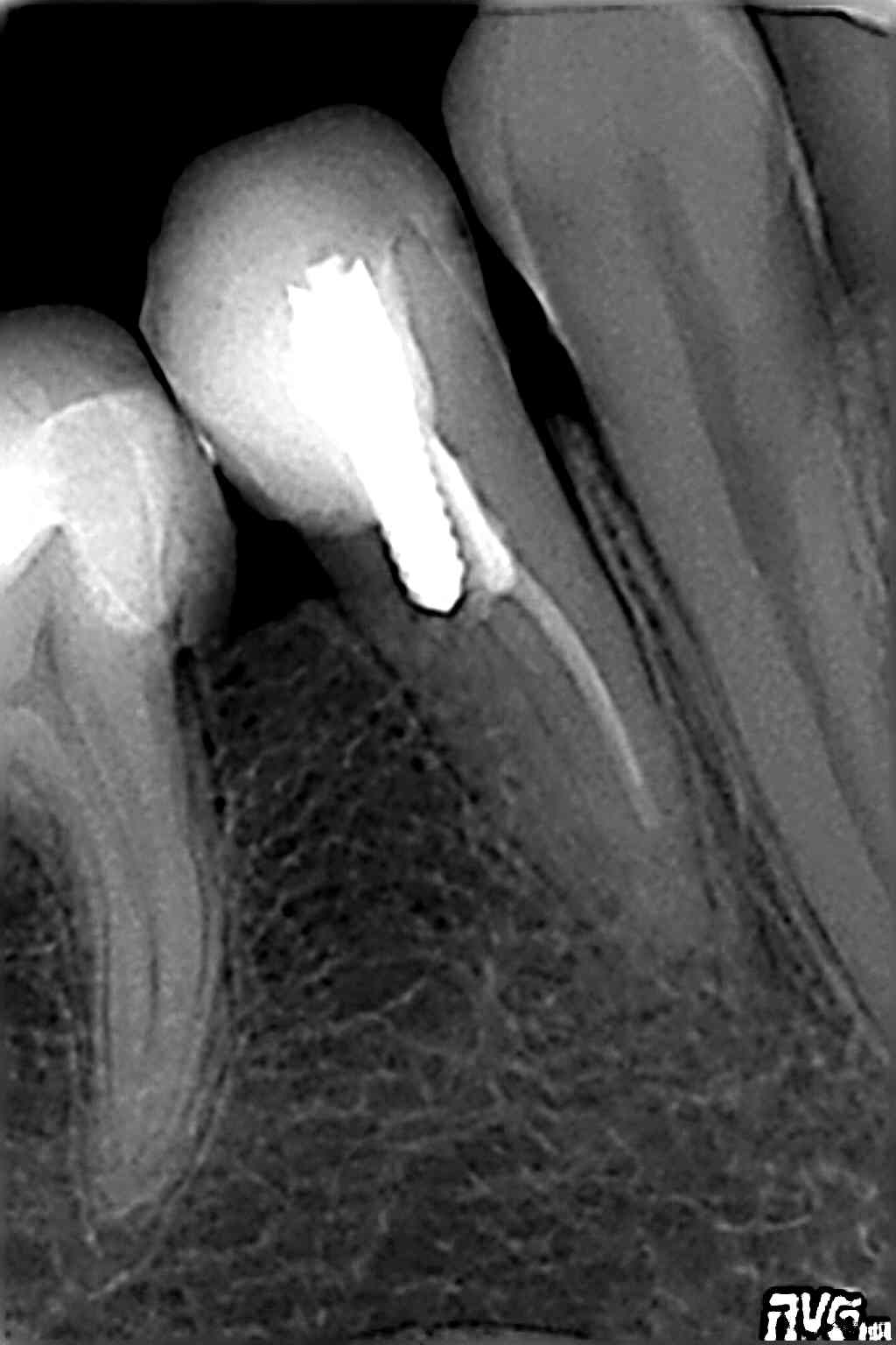 rentgen stomatologiczny gliwice