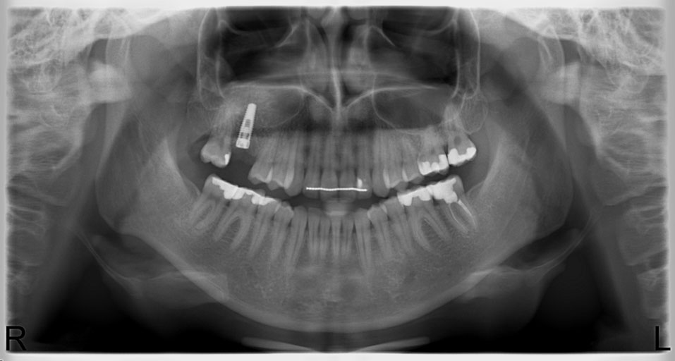 RTG stomatologiczny gliwice